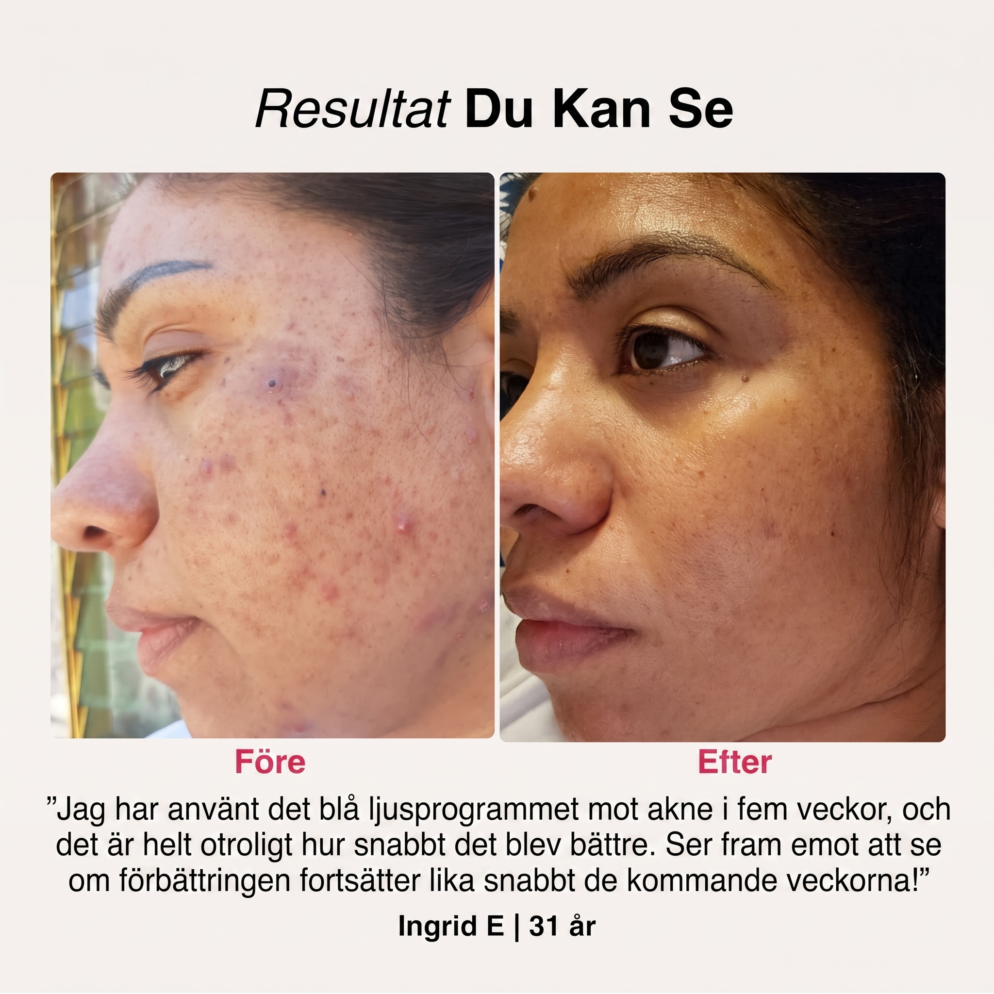 SoftSkin InfraLight® | Ansikte, Hals & Bröst – bild 6