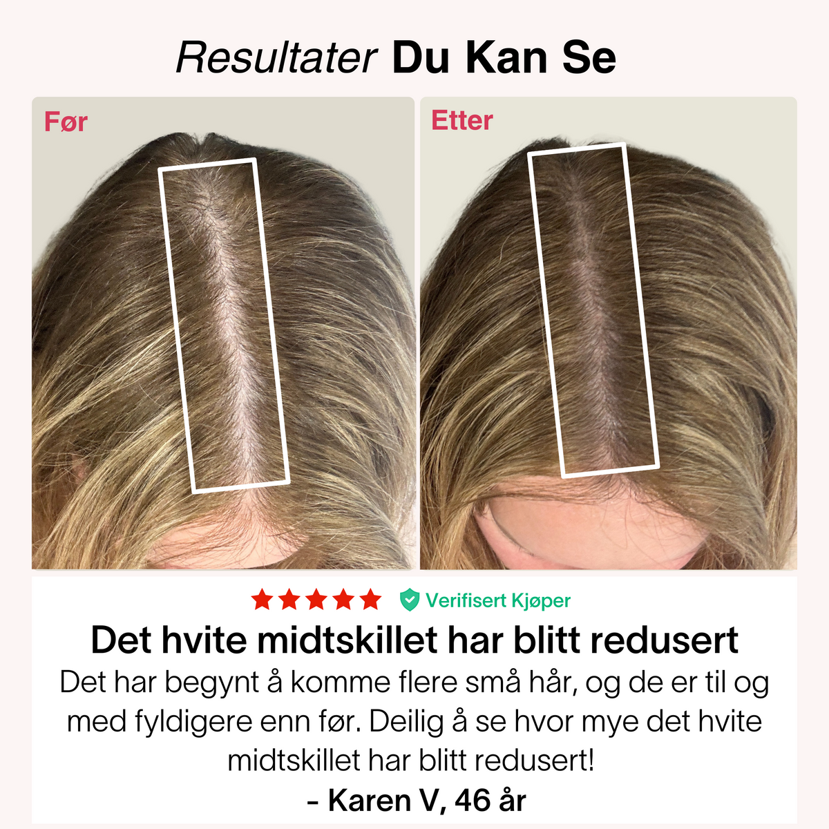 Rødlys-Capsen® – bilde 6