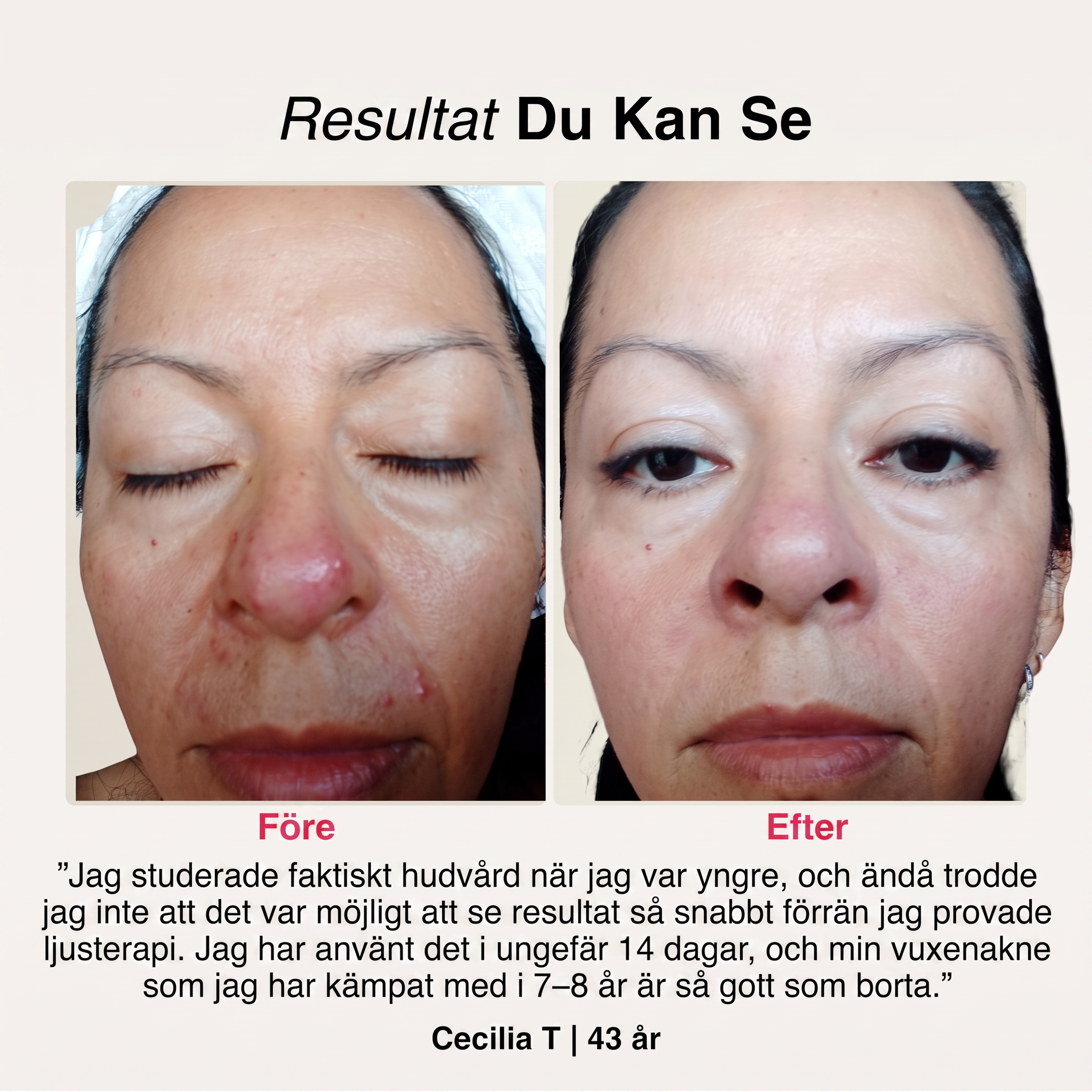 SoftSkin InfraLight® | Ansikte, Hals & Bröst – bild 5